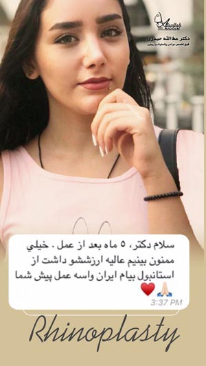 نمونه کار جراحی بینی دکتر حیدری