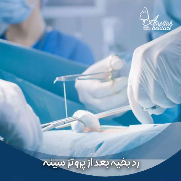 رد بخیه بعد از پروتز سینه