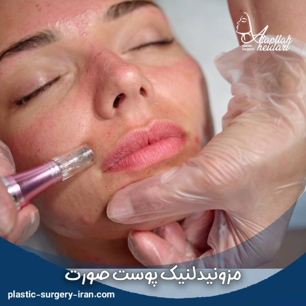 عکس مزونیدلینگ صورت