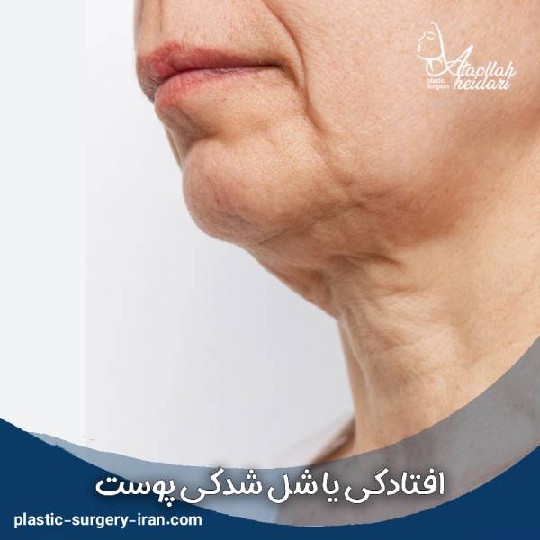 افتادگی پوست
