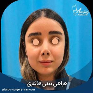 عمل بینی فانتزی