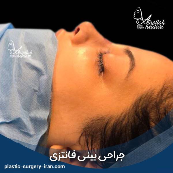 جراحی بینی فانتزی