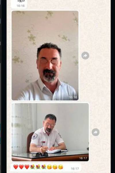 رضایت از لیفت صورت