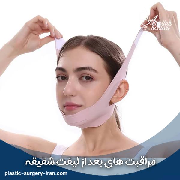 مراقبت های بعد از لیفت شقیقه