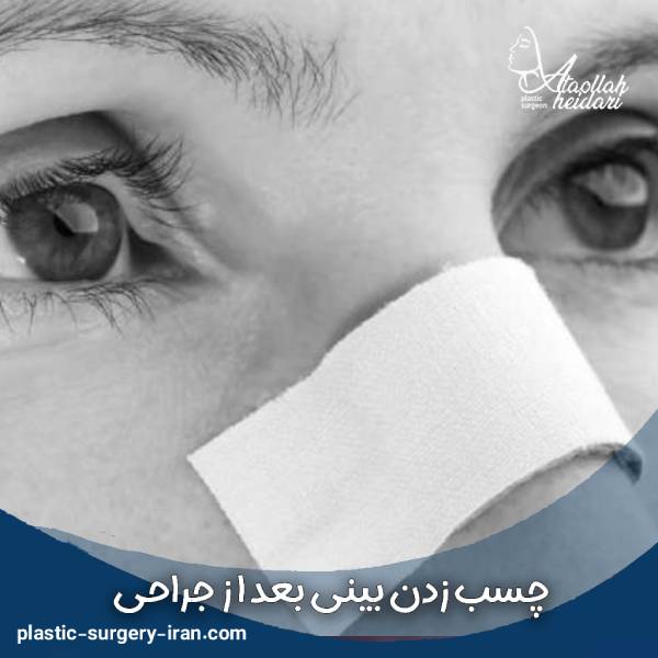 چسب زدن بینی 