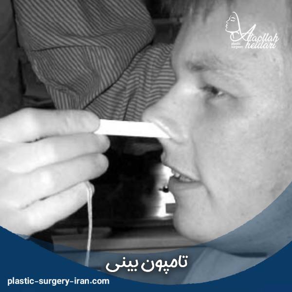 تامپون بینی