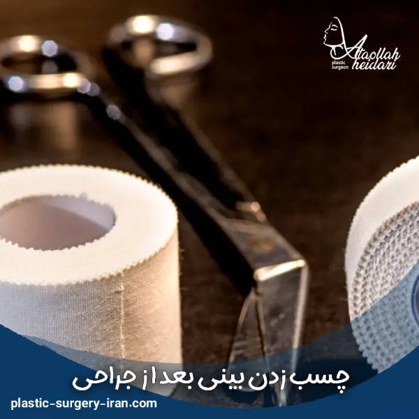 چسب زدن بینی بعد از جراحی