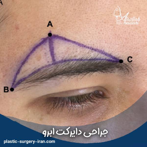 عکس عمل دایرکت ابرو