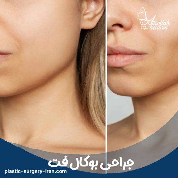 عمل بوکال فت