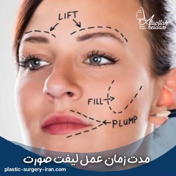 مدت زمان عمل لیفت صورت