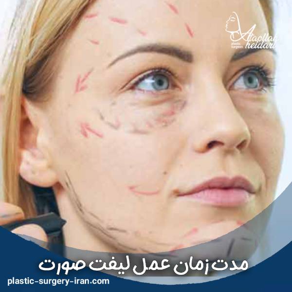 مدت زمان عمل لیفت صورت